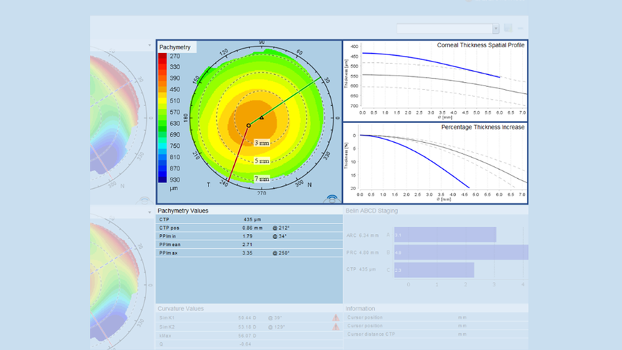 Eyestar 900 - Anterior Chamber Suite